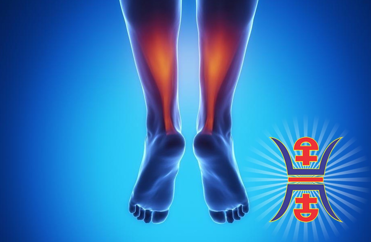 Achilles-Tendinitis